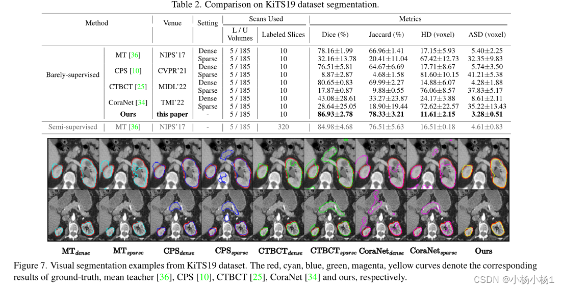 正交标注有利于无监督医学图像分割_orthogonal annotation benefits barely-supervised m-CSDN博客