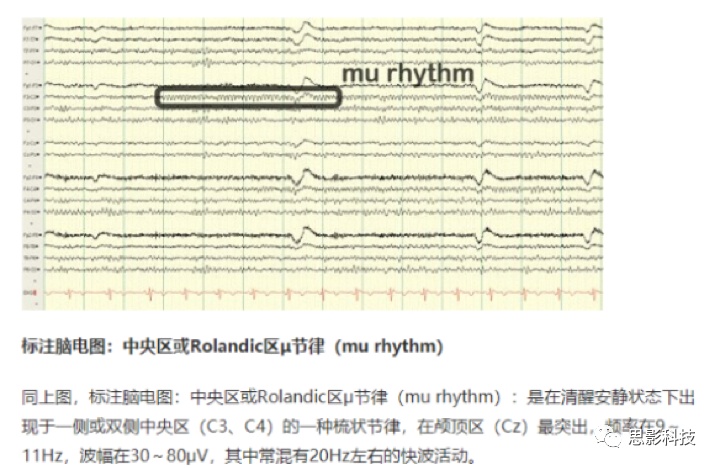 fd16c72ffffd7c46abca2030e1b883ab.png