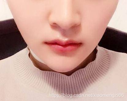 隆鼻有哪些后遗症，隆鼻术后注意事项有哪些？