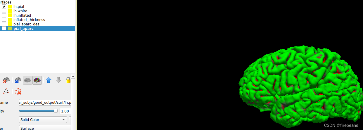 FreeSurfer入门(1) Output Data-CSDN博客