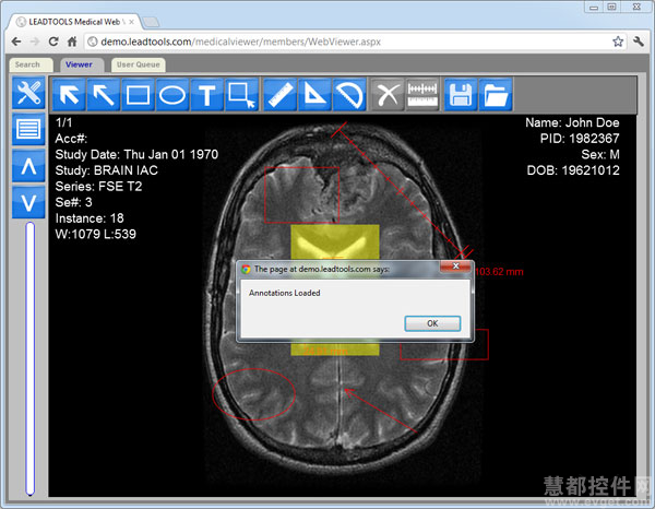 使用html查看dicom,LEADTOOLS构建HTML5 DICOM/PACS查看器（二）-CSDN博客