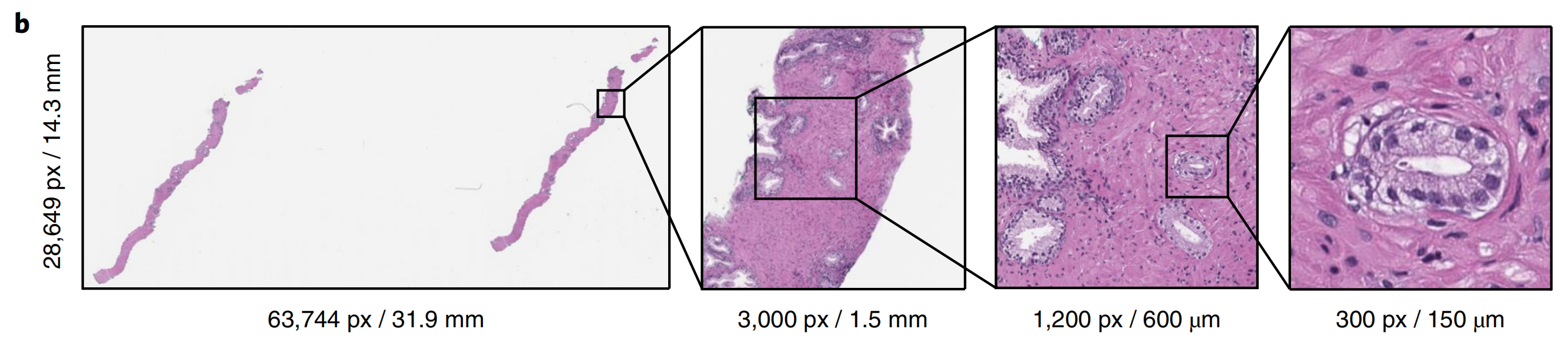 为什么需要切片扫描仪多实例学习在无需像素级注释的情况下，大规模训练分类模型｜顶刊精析·24-06-05_https://www.jmylbn.com_新闻资讯_第6张