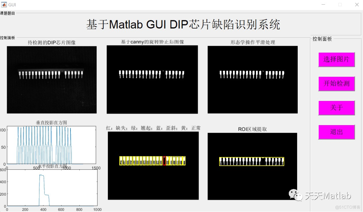 【芯片缺陷检测】基计算机视觉实现DIP芯片缺陷检测系统附GUI_图像处理