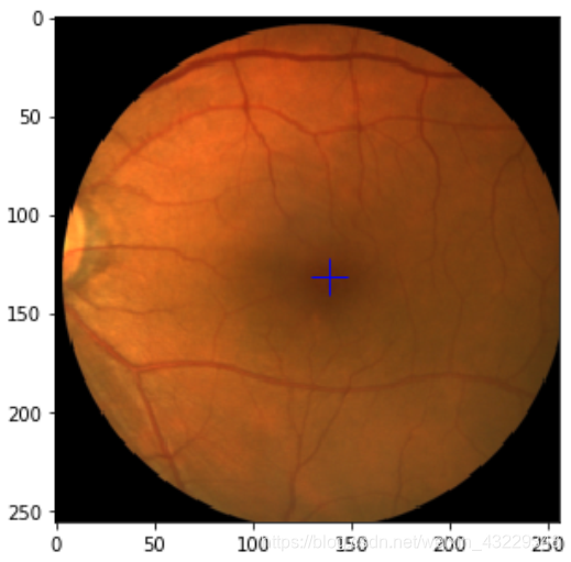 显示图片以及标签