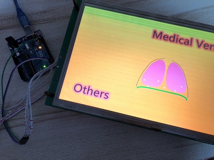 医用呼吸机怎么用uno arduino_医用呼吸机+ STONE LCD + Arduino UNO_https://www.jmylbn.com_新闻资讯_第21张