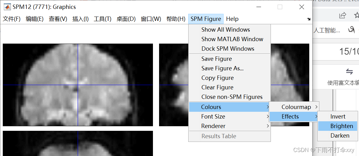 【matlab】spm数据处理_matlab spm-CSDN博客
