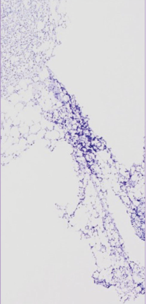 VectaPlex™ Antibody Removal Kit  ——简化您的多重免疫荧光(mIHC)染色
