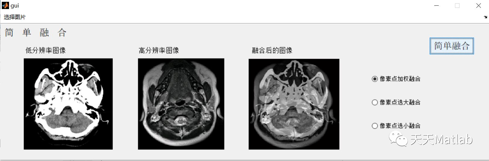 【图像融合】基于像素点图像融合matlab代码_参考文献