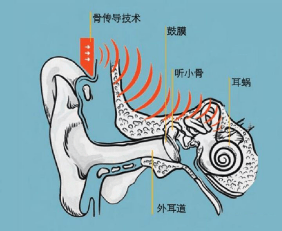 怎么使用听诊器骨传导耳机效果怎么样，骨传导耳机有什么优劣势_https://www.jmylbn.com_新闻资讯_第4张