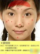 2010030209515288.jpg