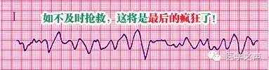 65e1ad7968e9a0927ce52391a17c0508.png