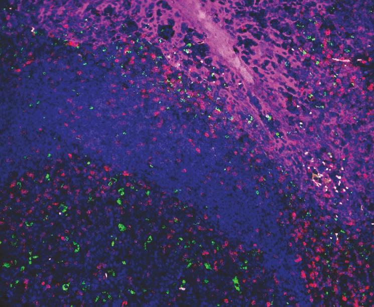 VectaPlex™ Antibody Removal Kit  ——简化您的多重免疫荧光(mIHC)染色