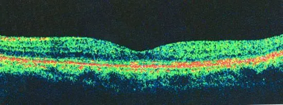 2530112-b05faf14687543aa