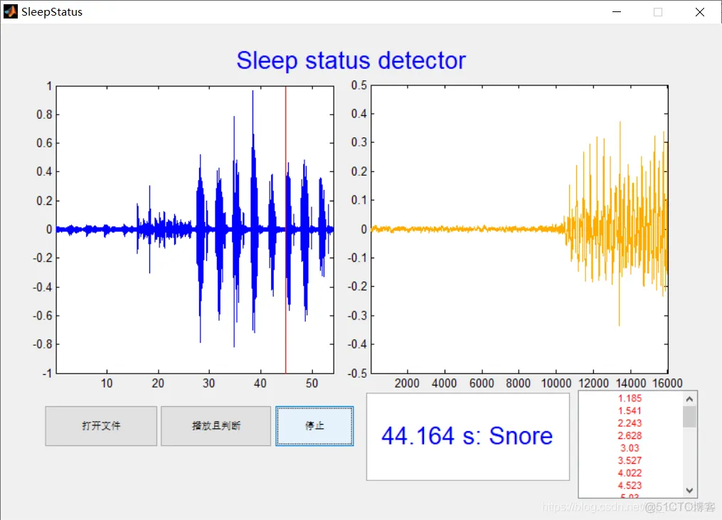 【信号处理】基于HMM的睡眠状态检测matlab源码_睡眠生理信号