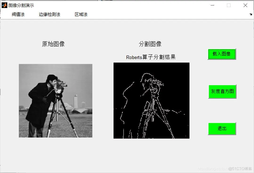 【图像分割】基于阙值+边缘检测+区域法图像分割matlab源码含GUI_matlab_03