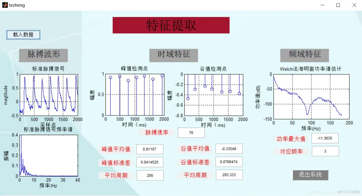 【肌电信号】脉搏信号分析(去噪+特征提取)matlab 源码含GUI_EMG_03