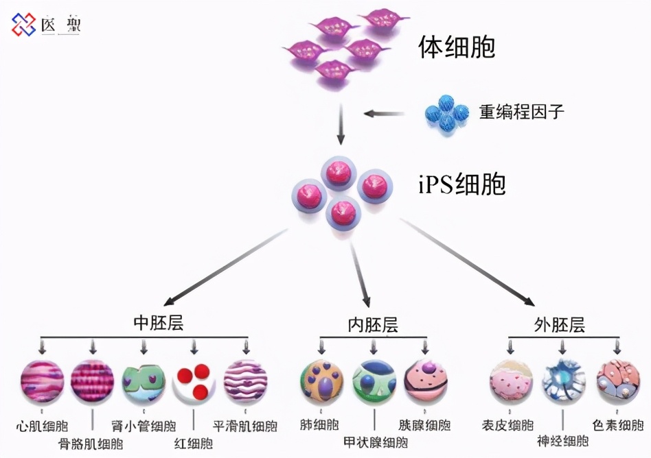 iPS细胞治疗糖尿病的研究