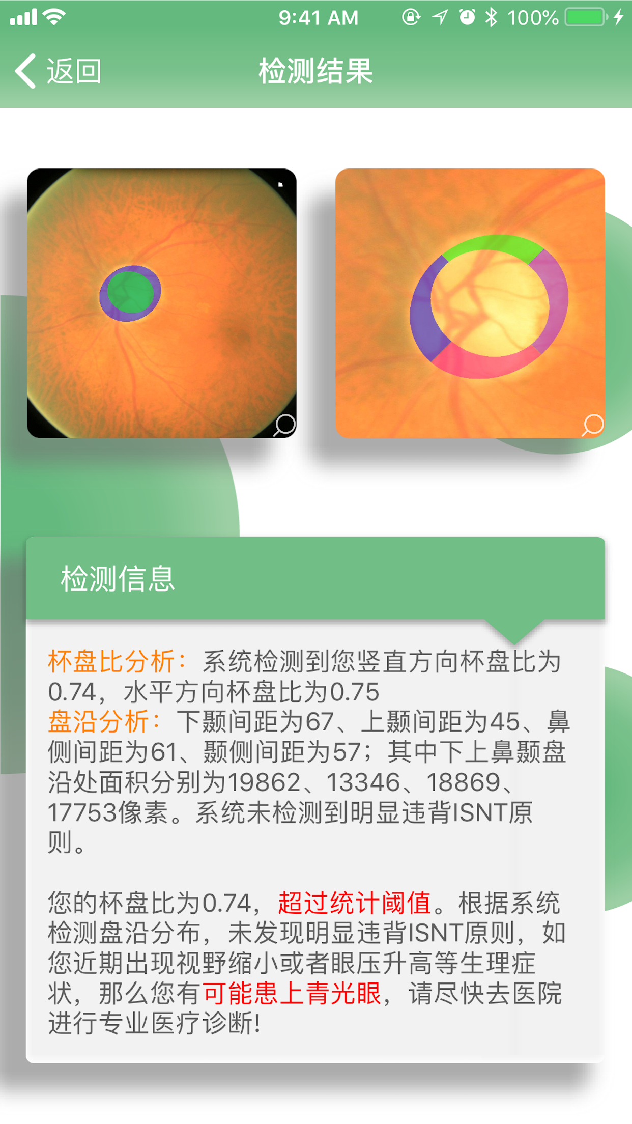 1294682-20180712205830739-933483791.png