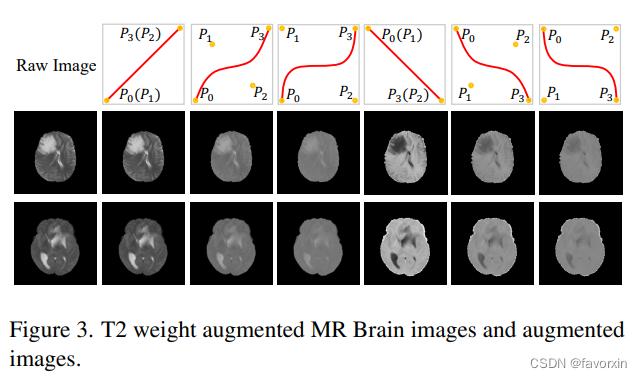 Generalizable Medical Image Segmentation via Style Augmentation and ...