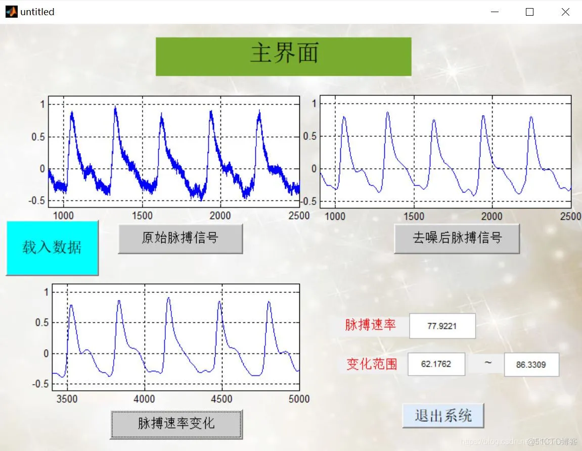 【肌电信号】脉搏信号分析(去噪+特征提取)matlab 源码含GUI_EMG_06