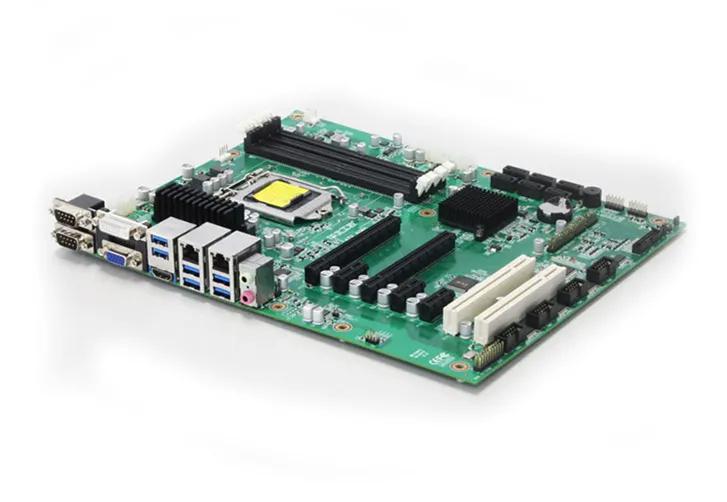 基于X86+FPGA+AI数字化医疗设备：全自动尿沉渣检测仪_fpga开发_02