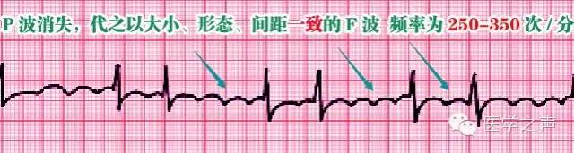 6ff5048859226cbf301a359ddde91be5.png