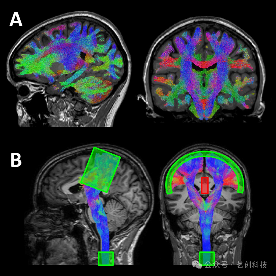 基于扩散MRI的连接_dmri-CSDN博客