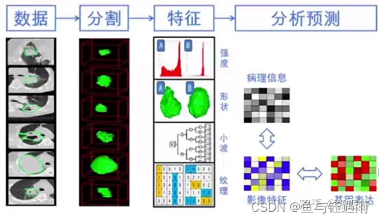 【生物信息】影像组学入门实践成长营(14天)_生境分析影像组学-CSDN博客