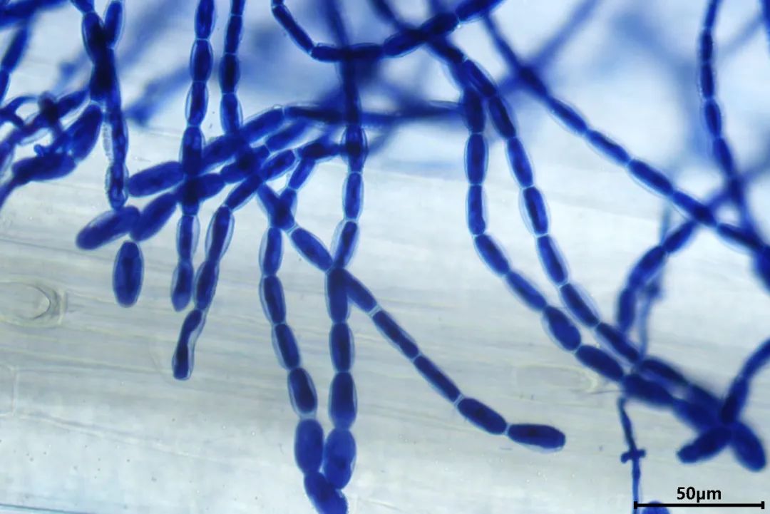 MPB | 基于形态学和分子生物学手段鉴定植物病原真菌-白粉病菌-CSDN博客