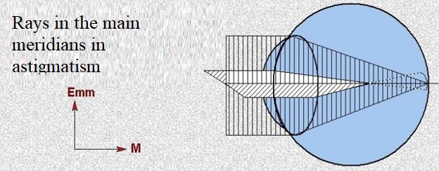 Зрение при астигматизме