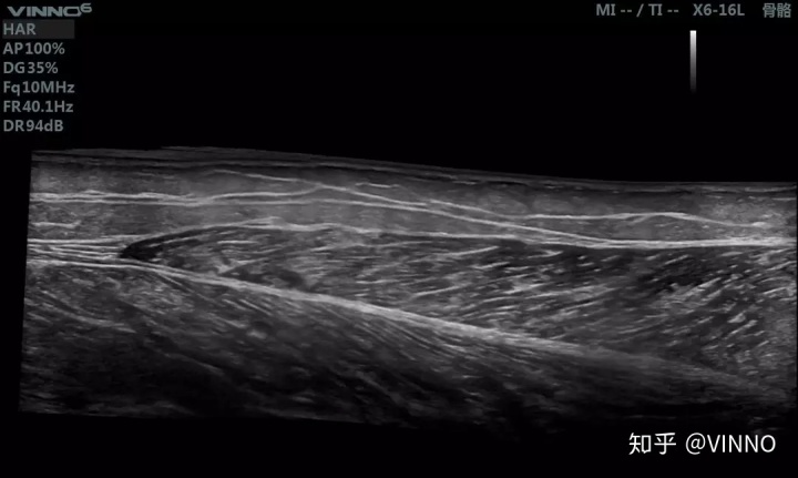 手机怎么拍摄x射线ct与x光的哪个辐射大_一篇读懂｜X光／CT／核磁／B超分别看什么，有没有辐射？_https://www.jmylbn.com_新闻资讯_第6张