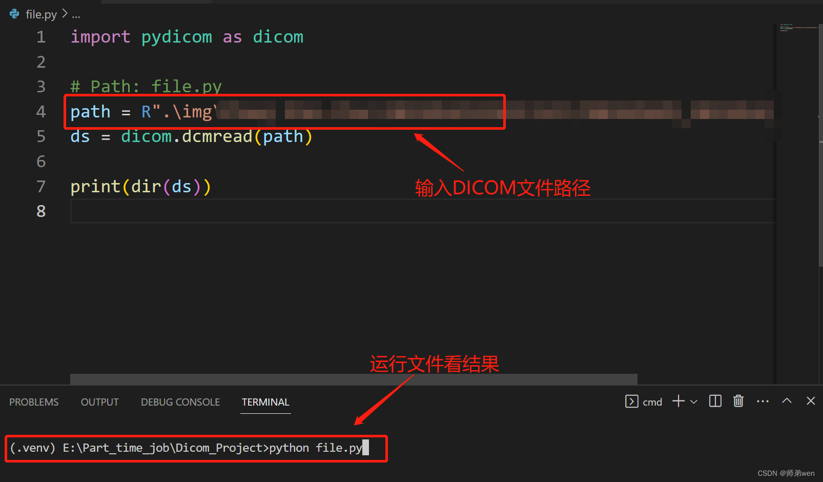 使用python打开DICOM文件_python加载dicom文件-CSDN博客