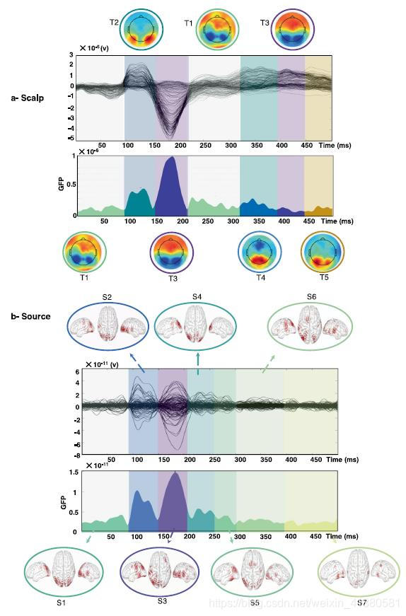 动态脑电图怎么看用于追踪认知任务期间的亚秒级脑动态的高密度脑电_https://www.jmylbn.com_新闻资讯_第9张