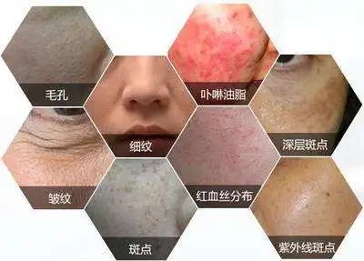 477bfc590c84915ec7b985a914473b9d.png