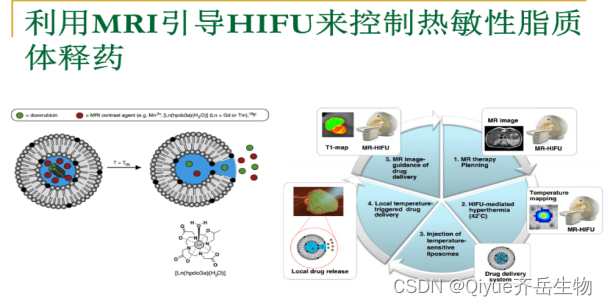 MRI造影脂质体，磁共振成像（Magnetic Resonance Imaging，MRI）造影剂_核磁增强造影剂的分子量-CSDN博客