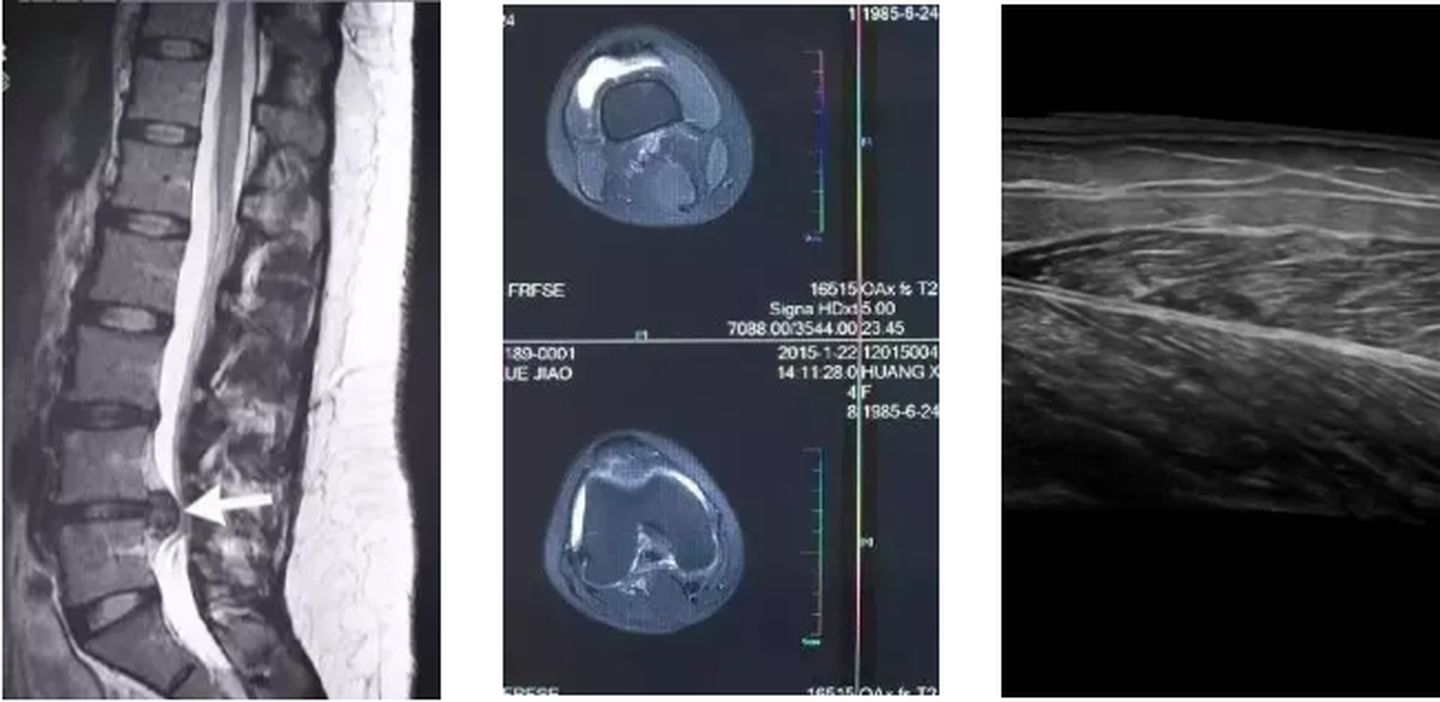 手机怎么拍摄x射线ct与x光的哪个辐射大_一篇读懂｜X光／CT／核磁／B超分别看什么，有没有辐射？_https://www.jmylbn.com_新闻资讯_第1张