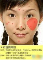 2010030209541741.jpg