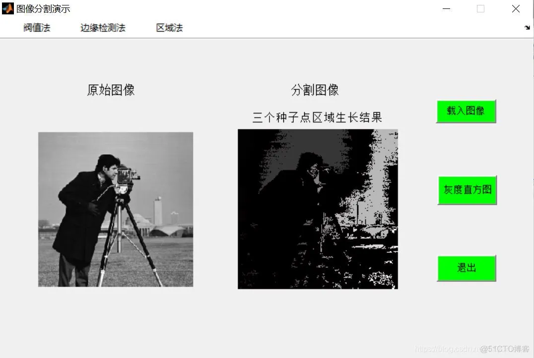 【图像分割】基于阙值+边缘检测+区域法图像分割matlab源码含GUI_matlab
