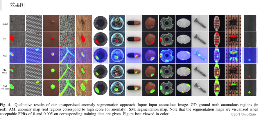 DFR: Deep Feature Reconstruction for Unsupervised Anomaly Segmentation ...