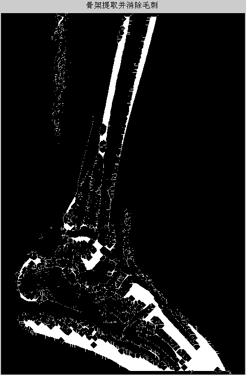 v2-3d3a85391a75e8b4486c69ce1a0d0912_b.jpg