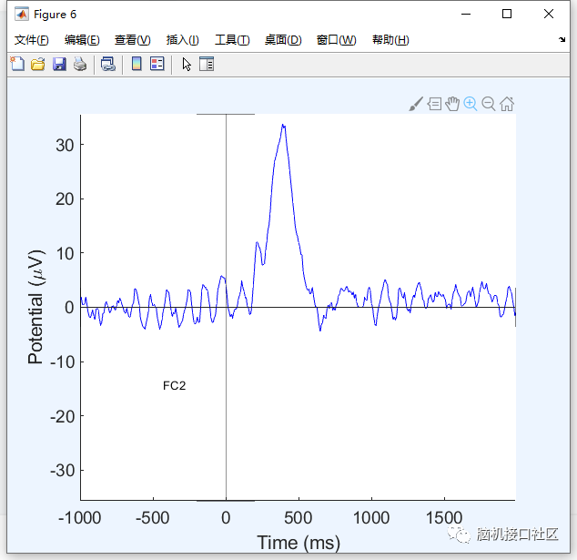 ad5d254ec1eac49e229ae42eb6765e38.png