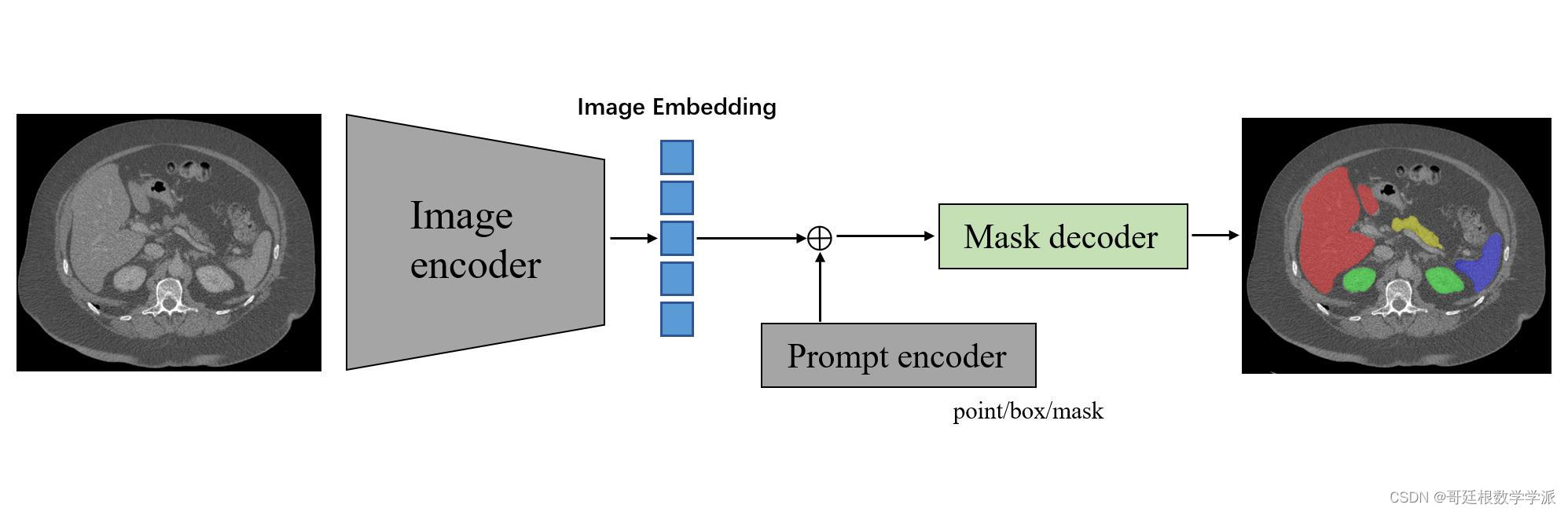 Segment Anything Model (SAM) for Medical Image Segmentation_ladder fine ...