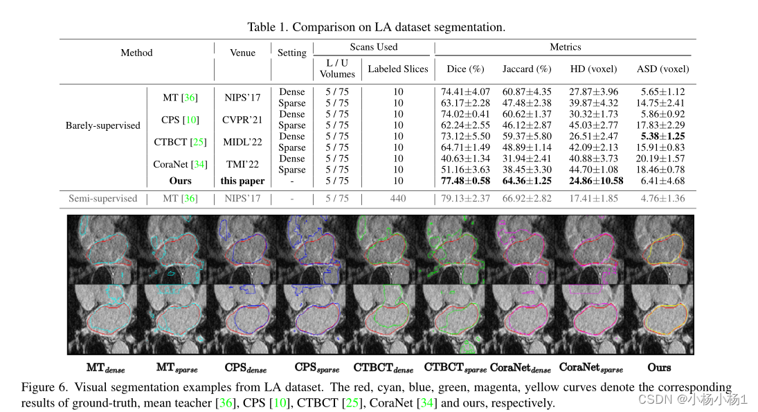 正交标注有利于无监督医学图像分割_orthogonal annotation benefits barely-supervised m-CSDN博客