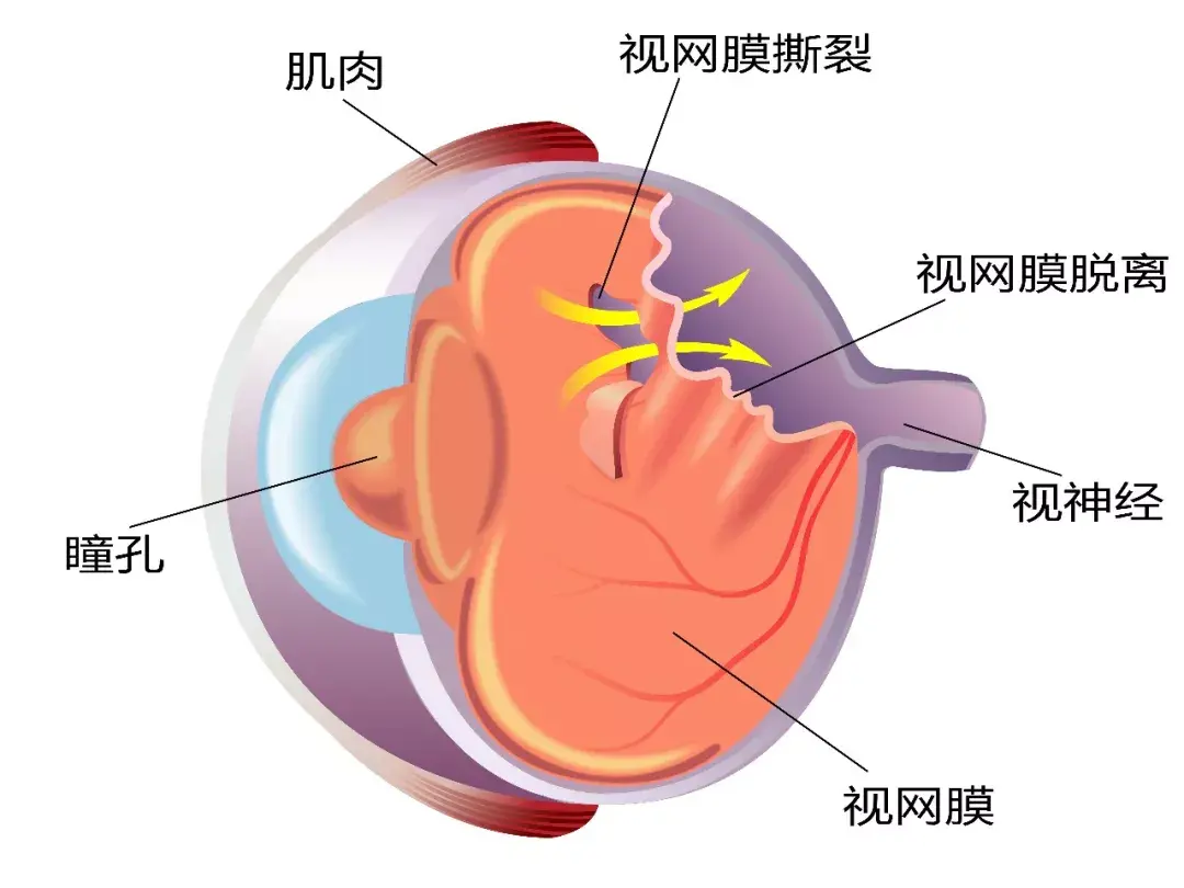 2530112-11dd18690bc4e72f.png