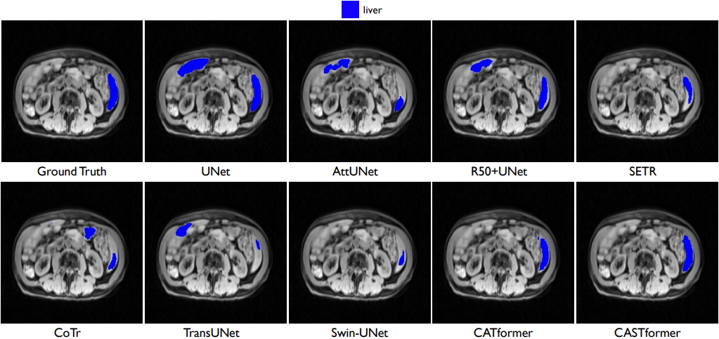 Visual comparisons with other methods on MP-MRI dataset