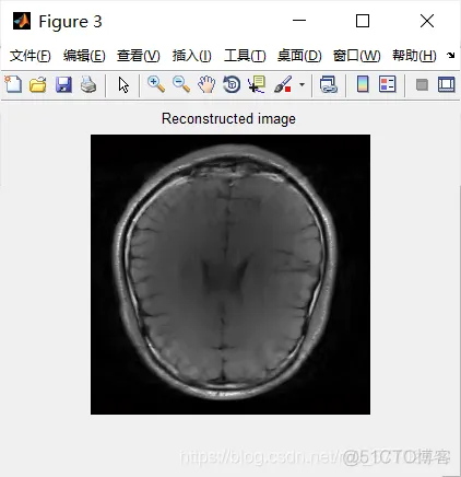 【图像融合】基于平移不变小波变换实现CT图像融合matlab源码_matlab_09