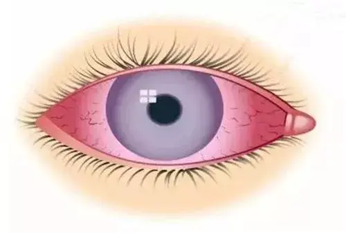 2530112-e84faf73729a5e08.png