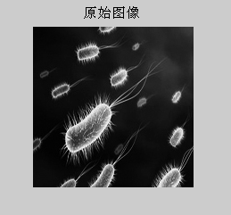 v2-3455ddd88474f9686cc528353b78756f_b.jpg