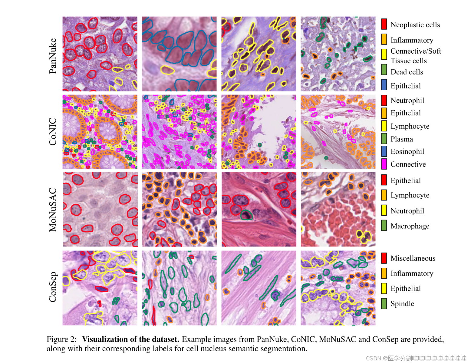 SEMI-SUPERVISED SEMANTIC SEGMENTATION OF CELL NUCLEIVIA DIFFUSION-BASED ...