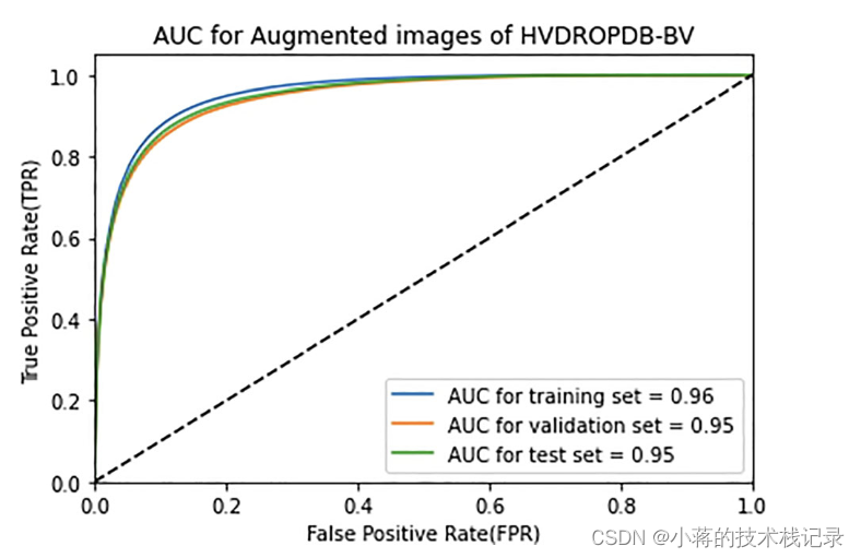 Deep dive in retinal fundus image segmentation using deep learning for ...